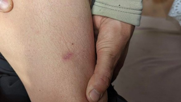 Во время допроса россияне воткнули финку в ногу жителю поселка Пески Радьковские Херсонской области. Фото сделано 19 октября. [Елизавета Сокуренко]